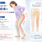お尻から太もも裏に響く坐骨神経痛が続いていた50代女性の症例