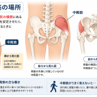 中殿筋が痛くなる理由とは？
